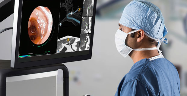 Scripps Robotic Bronchoscopy (Photo courtesy: Scripps Health)